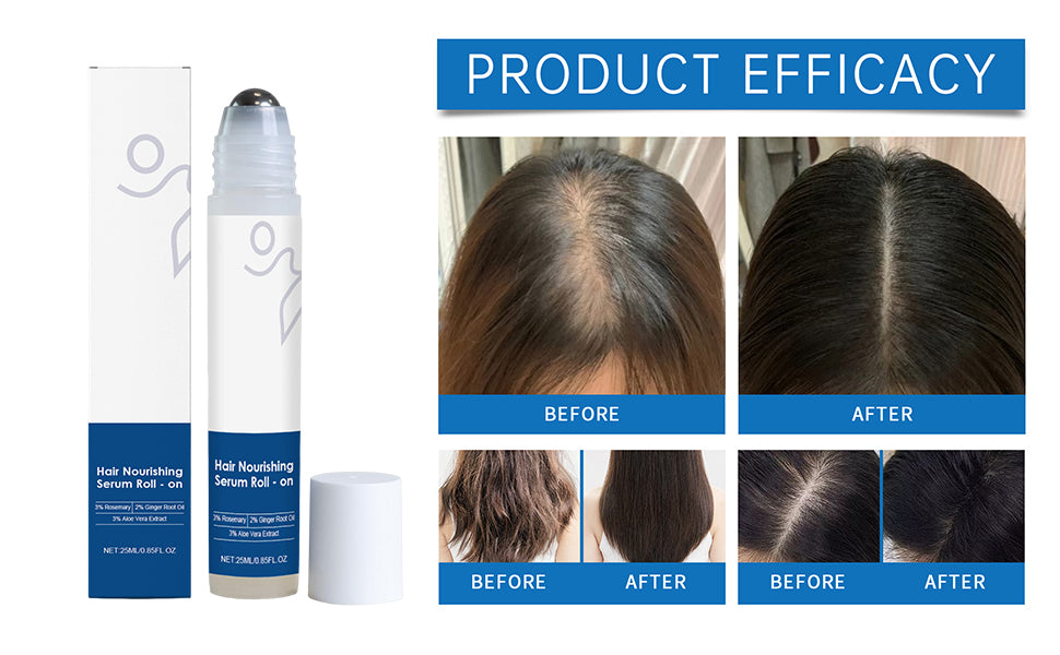 Serum Roll-On para el Crecimiento Capilar