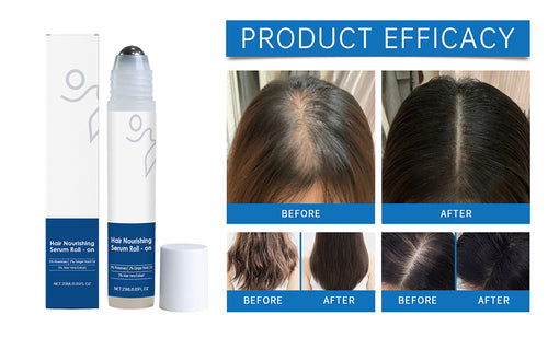 Serum Roll-On para el Crecimiento Capilar