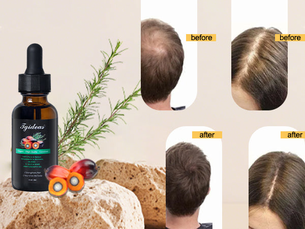 ACEITE DE BOTANA - FORMULA MEJORADA 100% NATURAL